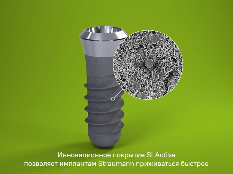 Благодаря SLActive импланты Straumann приживаются в 2 раза быстрее