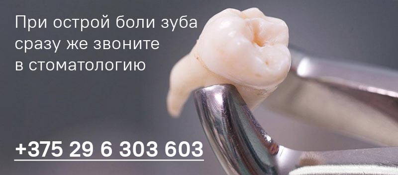 Удаление зубов в Минске по достопной цене